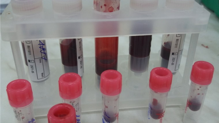 В 2019 году испытательная лаборатория в КУП Чувашской Республики «Агро-Инновации» продолжит исследования крови животных